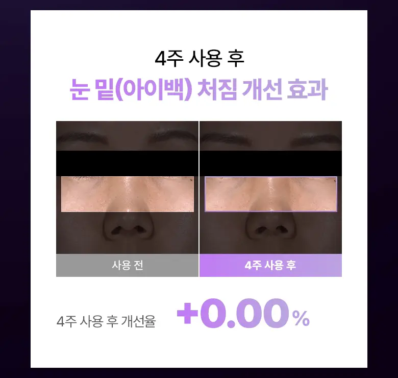 [NEW|아이백리프팅] 바이오힐보 프로바이오덤 콜라겐 PDRN 아이백 & 미간 패치 6,800샷 상세페이지 16